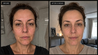 Nalaglow™ SilkGlow Collagen Peptide Ampoule