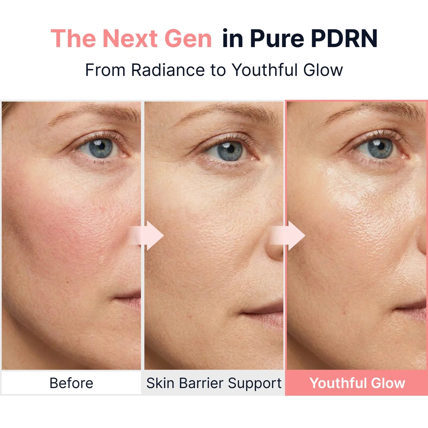 Nalaglow™ PDRN Vitamin Glow Boosting Ampoule