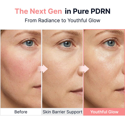 Nalaglow™ PDRN Vitamin Glow Boosting Ampoule