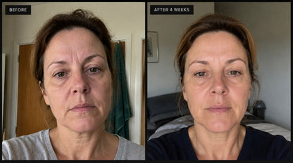 Nalaglow™ SilkGlow Collagen Peptide Ampoule