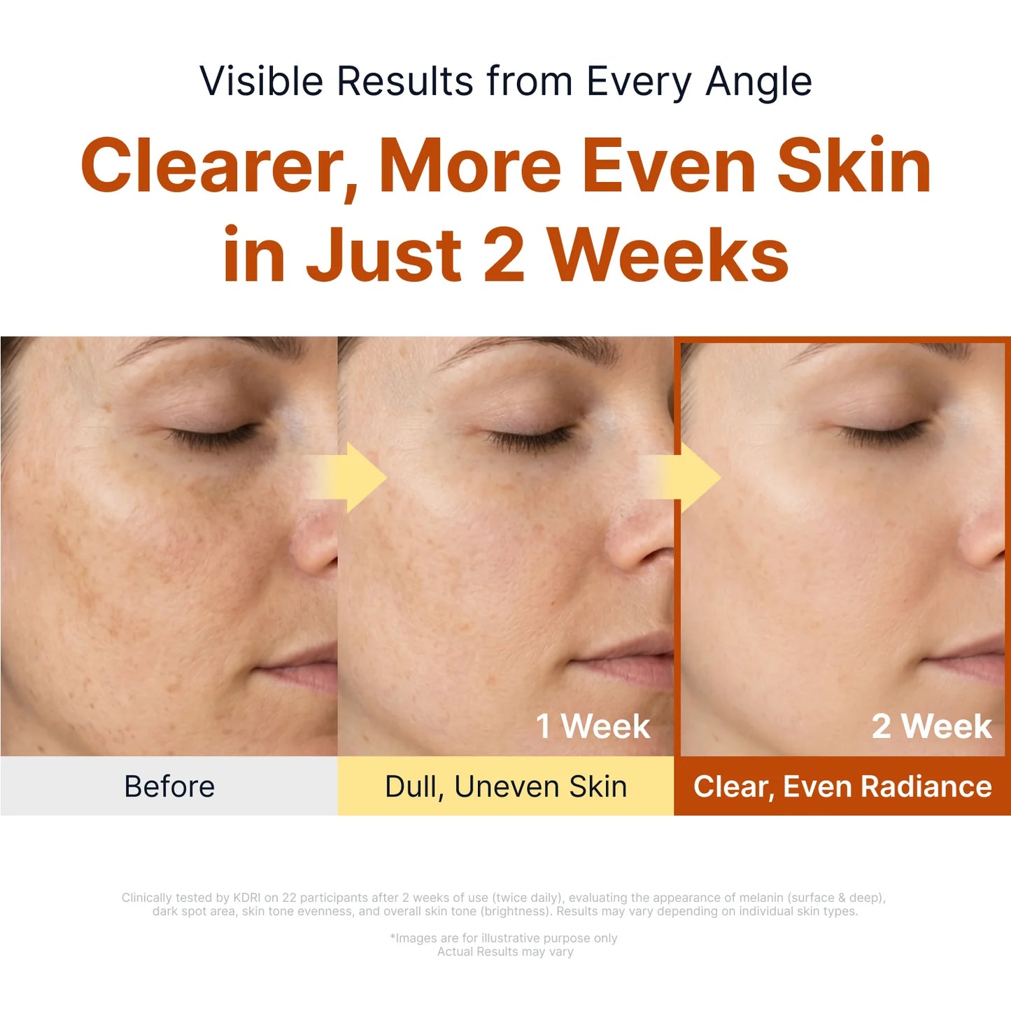 Nalaglow™ Kojic Niacinamide Brightening Ampoule