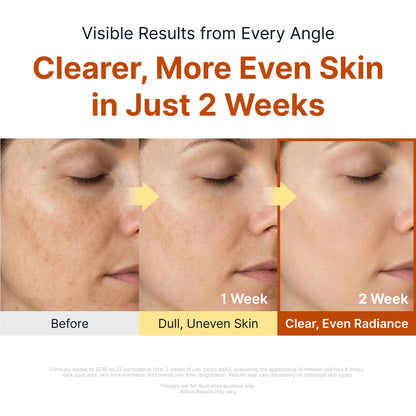 Nalaglow™ Kojic Niacinamide Brightening Ampoule