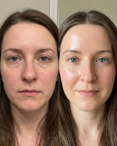 Nalaglow skincare result
