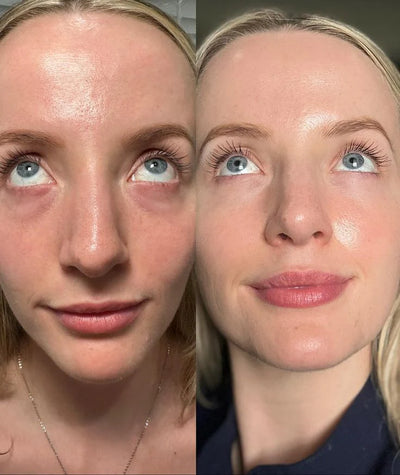 Nalaglow customer result