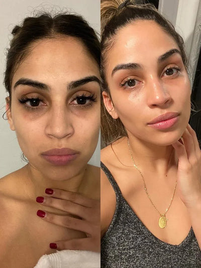 Nalaglow customer result